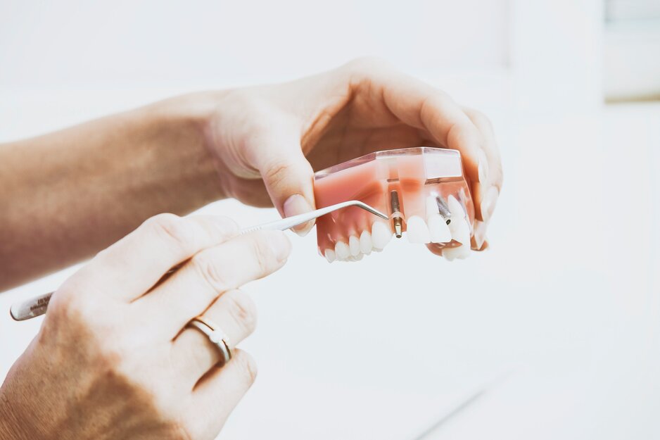 dentist showing dental implants on dentures