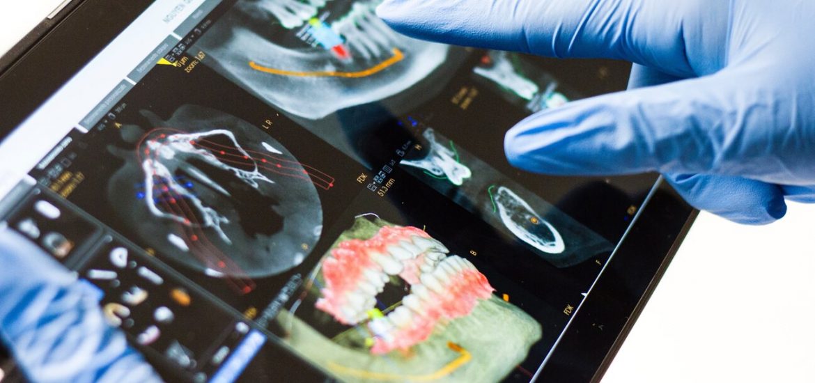 dentist pointing at dental x-rays on digital tablet