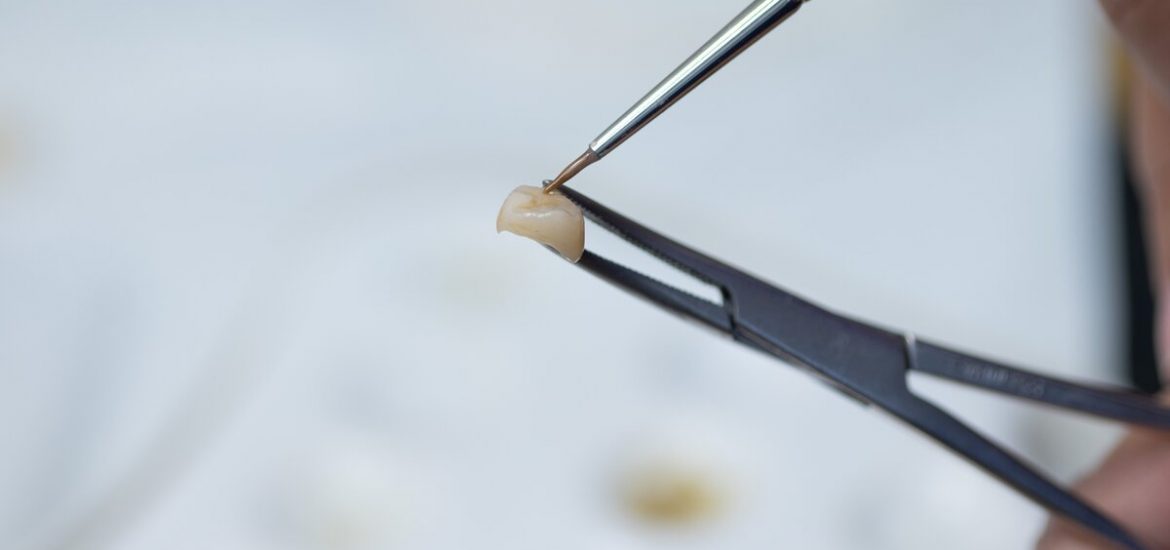 dental tweezers holding a tooth