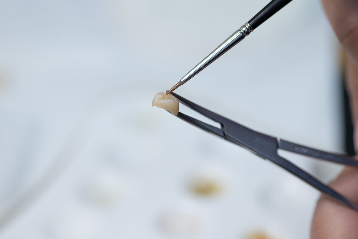 dental tweezers holding a tooth